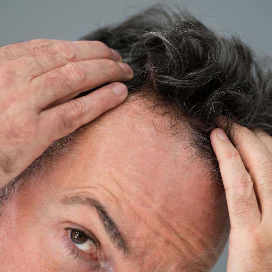 What is the Best Ultrasound-Based Hair Restoration Treatment?